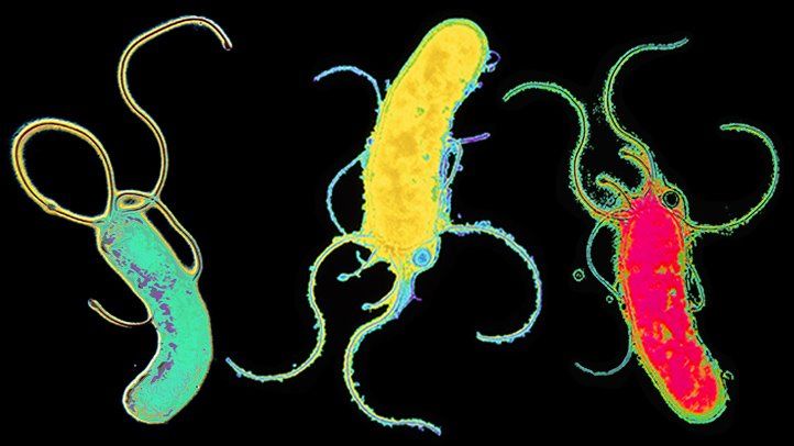 Take This Stomach Cancer Quiz for Better Understanding