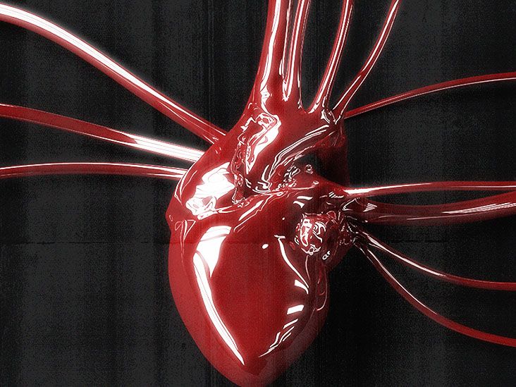 Mitral Regurgitation: Causes, Symptoms, Treatment, and More