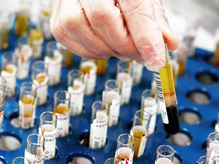 HIV treatment failure signs – what to watch for