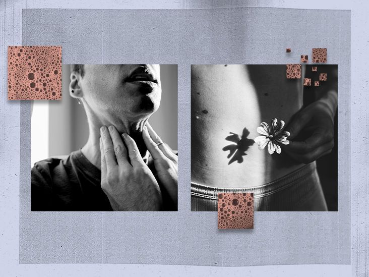 Esophagus and stomach cancers: What you need to know